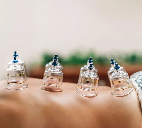 Auricular Acupuncture
